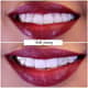 Slider image (7) FMS Dental Hospital - Kukatpally